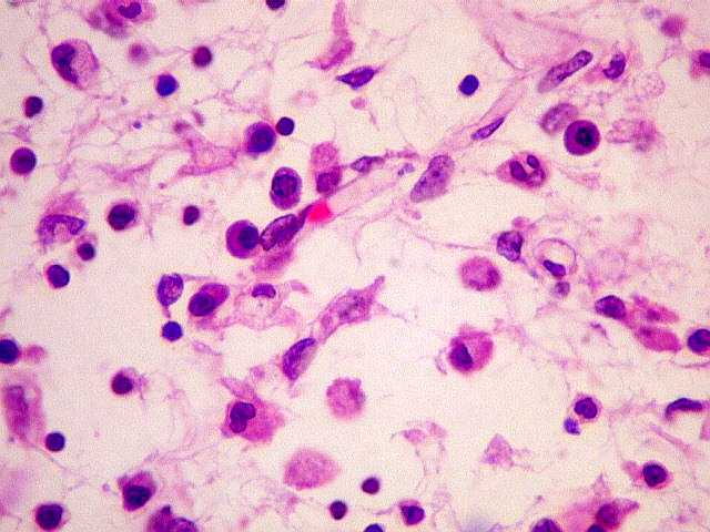 Inflamação sem paranoia: aprenda a identificar os sintomas, prevenir e tratar